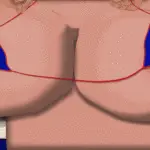 2880066 accidentgif | Free Adult Games